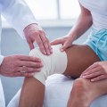 The Essential Role of Physical Therapists in Wound Care