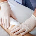 Which Types Of Wound Dressings Are Most Effective For Chronic Wounds?