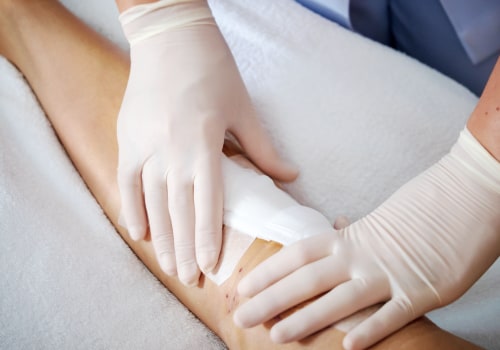 Which Types Of Wound Dressings Are Most Effective For Chronic Wounds?