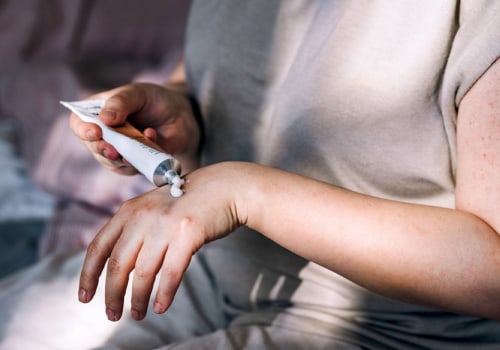 Is Mupirocin Ointment Right for Your Open Wound? Everything You Need to Know